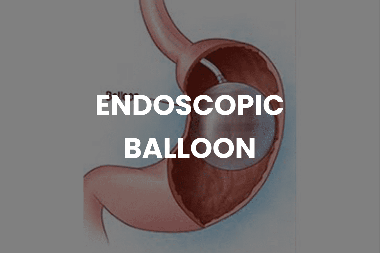 Endoscopic Balloon