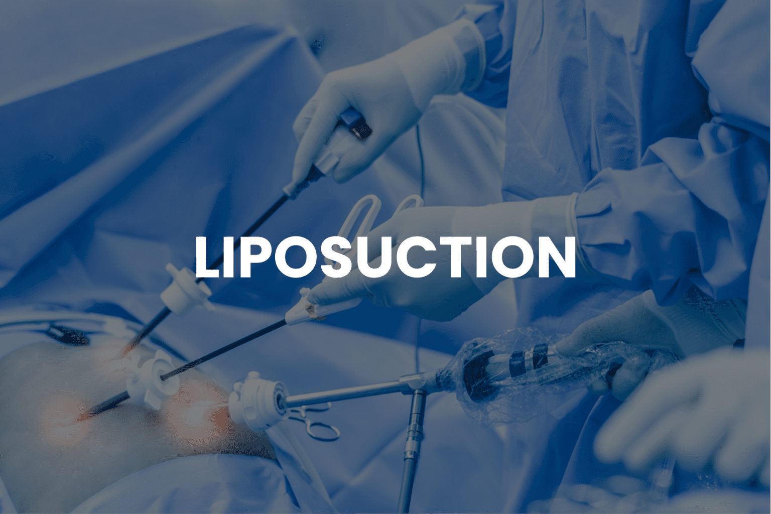 Liposuction