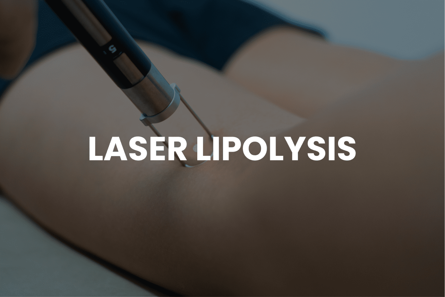 Laser Lipolysis