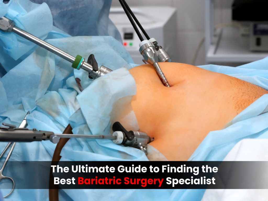 Bariatric surgery procedure performed by a specialist in Vizag, showing advanced laparoscopic weight loss surgery for safe and lasting results.